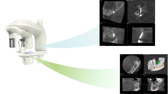 歯科用3D装置のイメージ
